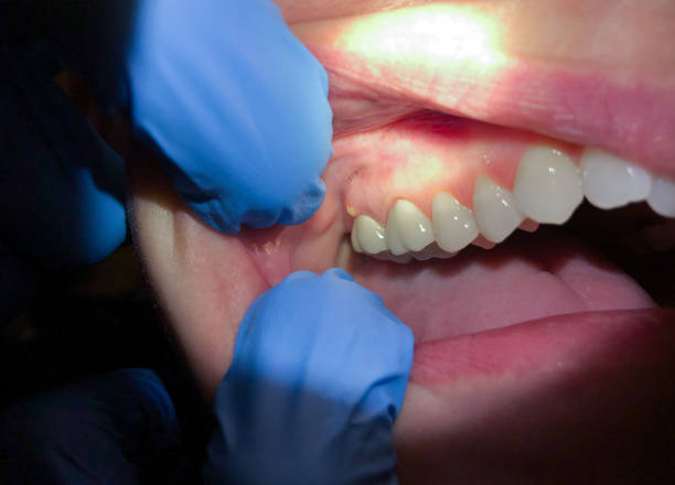 Best Emergency Dentist for Special Needs Patients in Rosedale, WA